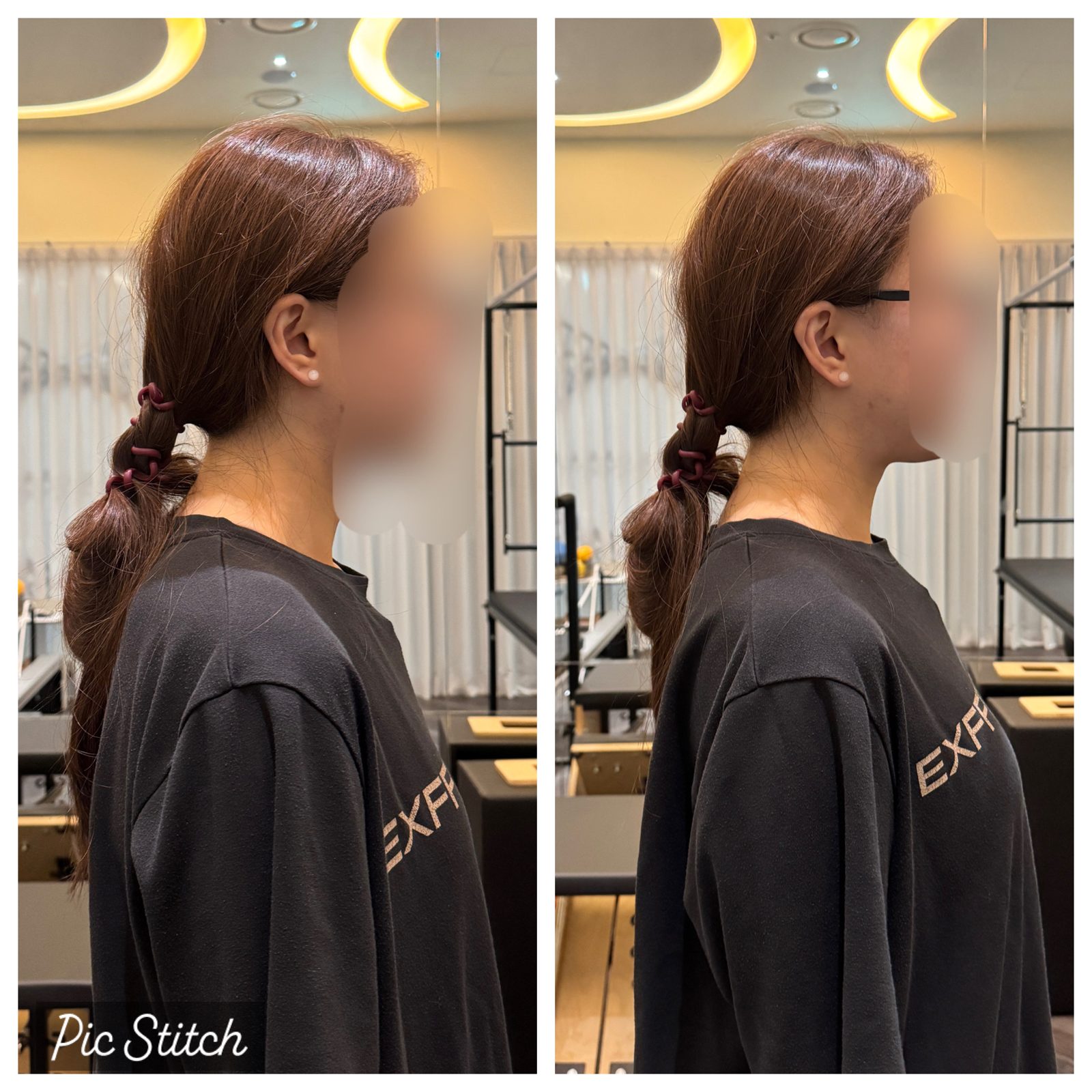 목·어깨 정렬 전후 비교 (측면)