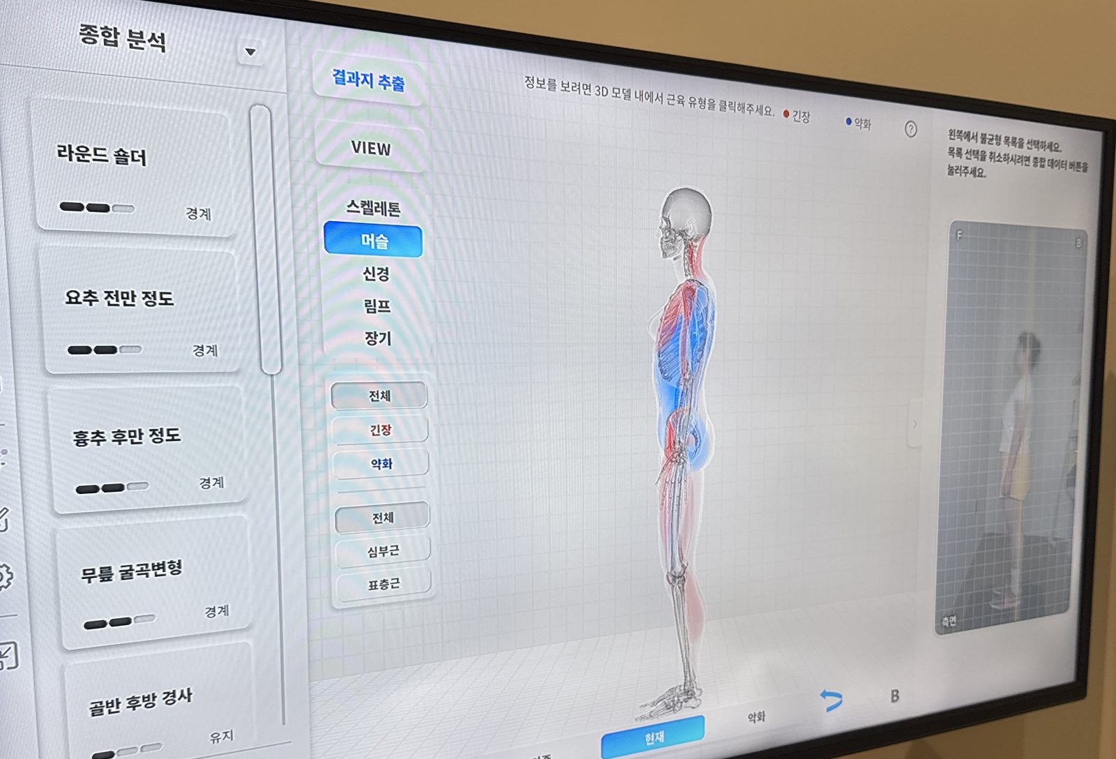Moti Physio 종합 분석 화면 — 3D 근육 긴장·약화 맵