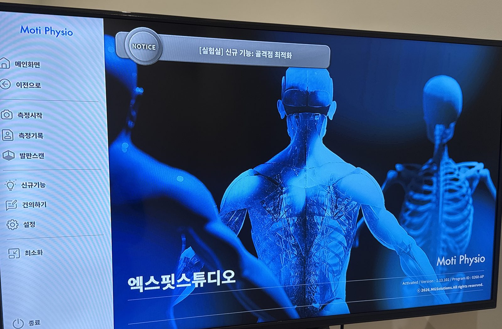 Moti Physio 장비 메인 화면 — 엑스핏 스튜디오